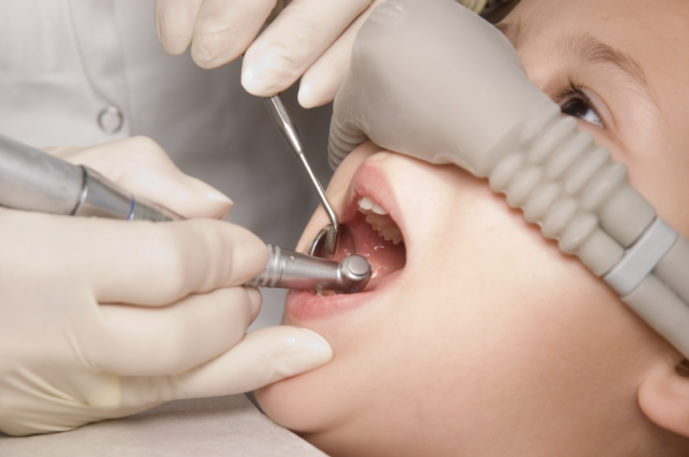 nitrous oxide | sedation dentist east hills, NSW