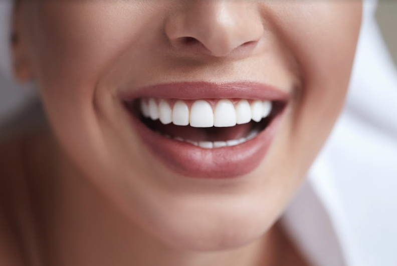 cosmetic dentistry east hills, NSW